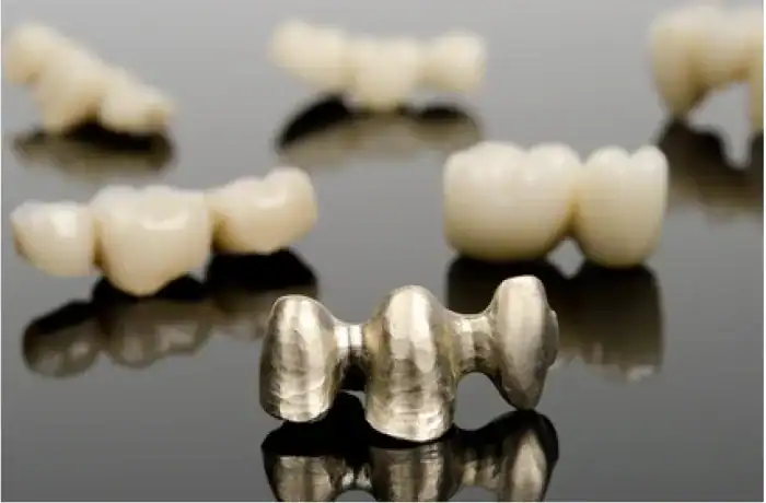 Zahngold Altgoldverkauf